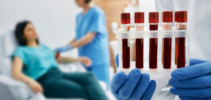 private blood tests chester
